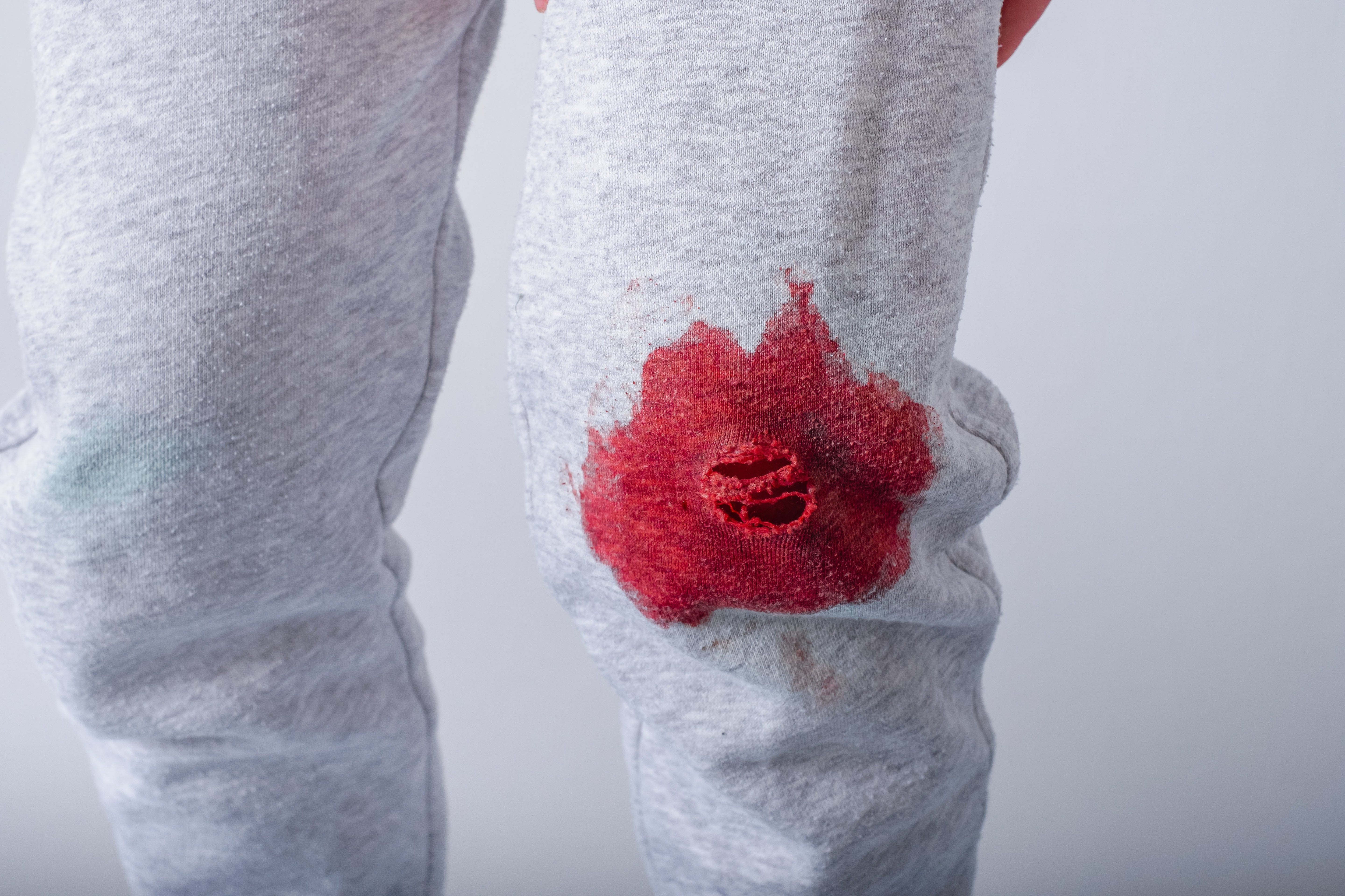 Blutflecken entfernen leicht gemacht: So bekommt Ihr die Flecken wieder aus der Kleidung